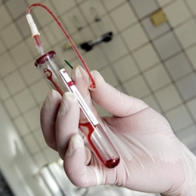 Как правильно сдавать кровь на эозифноилы?